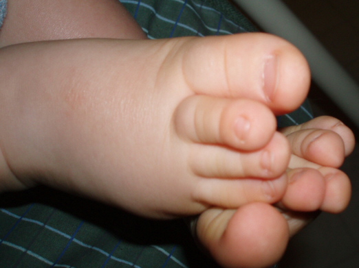 [baby+toes+121606.JPG]