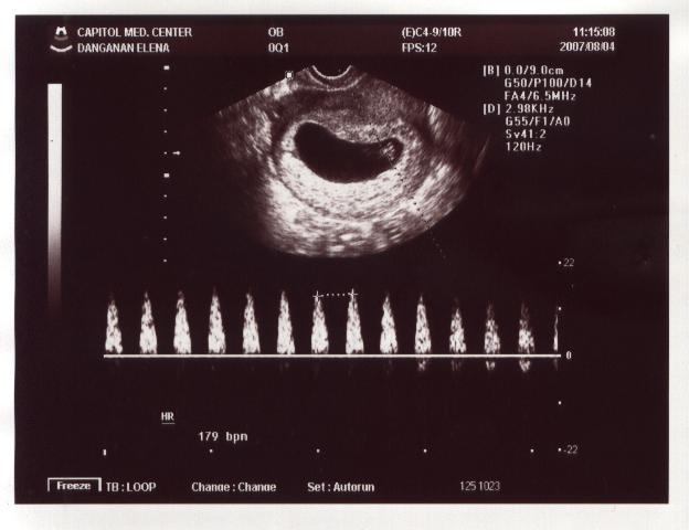 [ultrasound3.jpg]