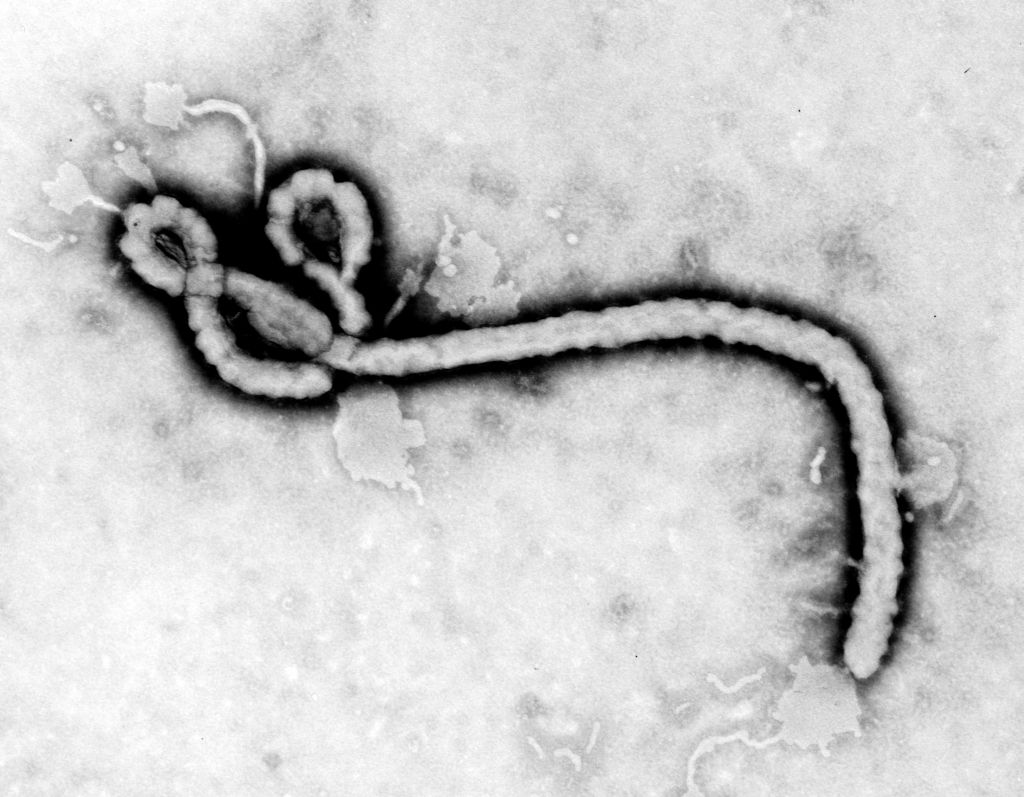 [gpw-20050430a-fullsize-Ebola-virus-CDC-PHIL-ID-1181.jpg]