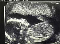 [ultrasound+of+a+HUMAN+BABY.jpg]