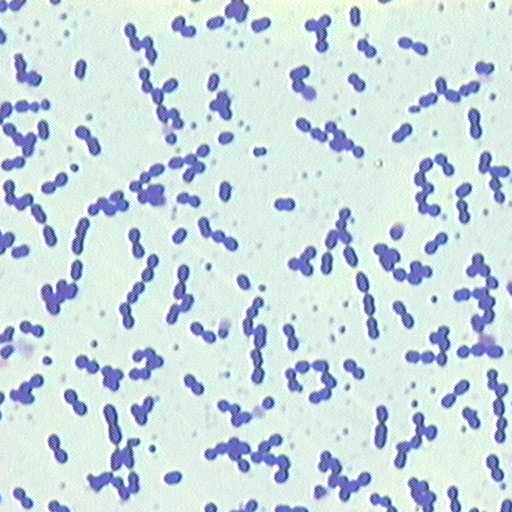 [Enterobacter+faecalis1.jpg]