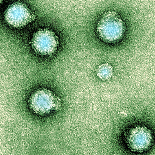 [Chikungunya+Virus.jpg]