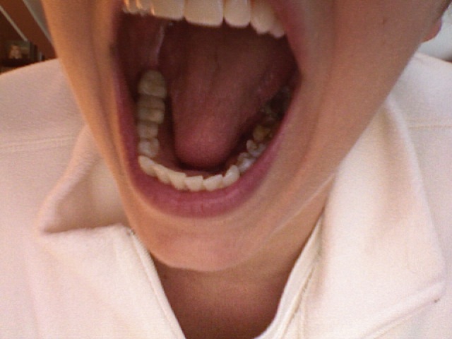 [teeth1.jpg]