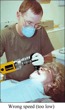 [Drill-Dental-B.jpg]