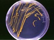 Microbial Growth in a Plate Culture media