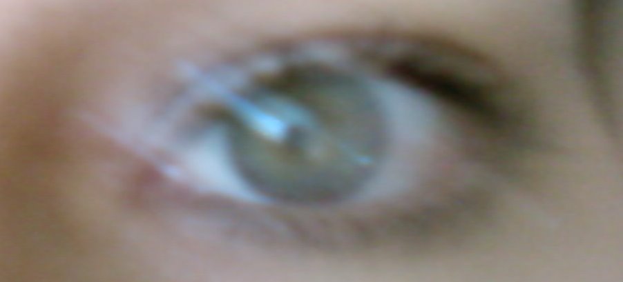 [eye.bmp]