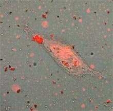 Seek and destroy: Magnetic nanoparticles (above, red) coated with cancer-targeting peptides can seek out and glom on to cancer cells like the one shown above. The peptides were designed to bind with a molecule found on the surface of ovarian-cancer cells. Researchers hope to use the nanoparticles to filter cancer cells from the abdominal fluid of patients with ovarian cancer, perhaps preventing metastasis.  Credit: J. Am. Chem. Soc. Copyright 2008 American Chemical Society