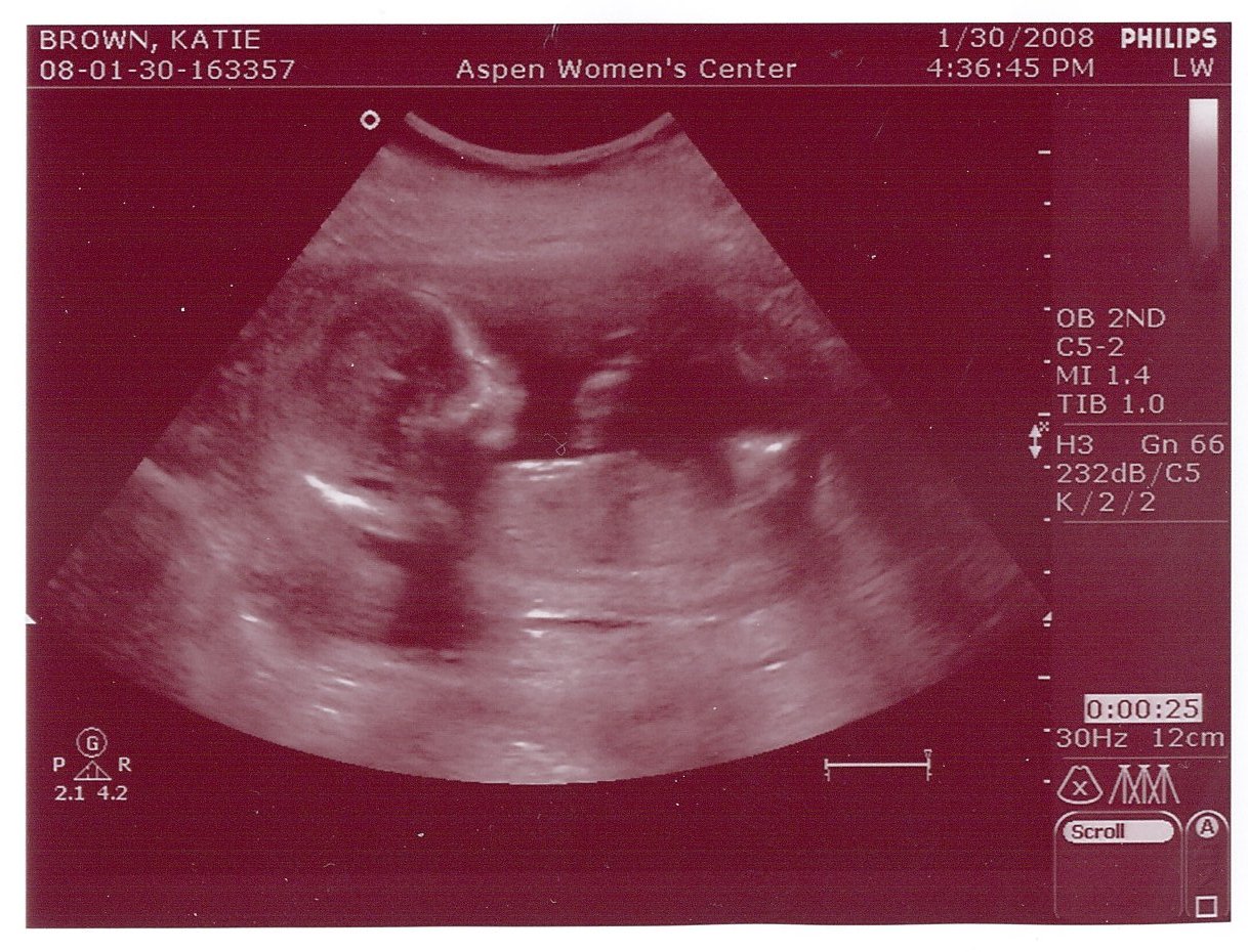 [Baby+Ultrasound+1.jpg]