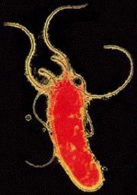 [Helicobacter+pylori.jpg]