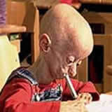 [a66_progeria.jpg]