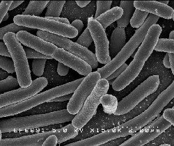 [Bacteria+EscherichiaColi.jpg]