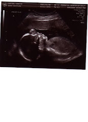 Baby A (Sierra), 21 wks 5 days pregnant