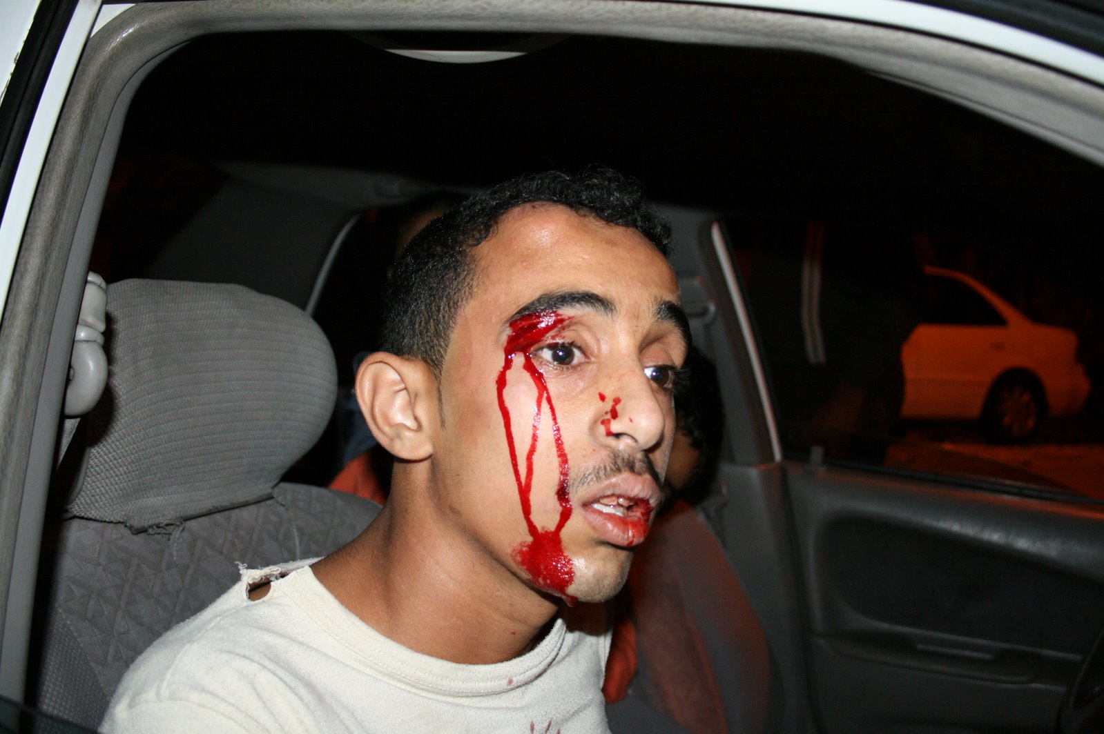 [victim+of+attack+on+peaceful+march-+Bahrain-7-12-07.jpg]