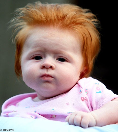 Redheads: * Baby born with a full head of Elvis-style ginger hair