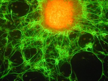 [cancer+stem+cells.jpg]