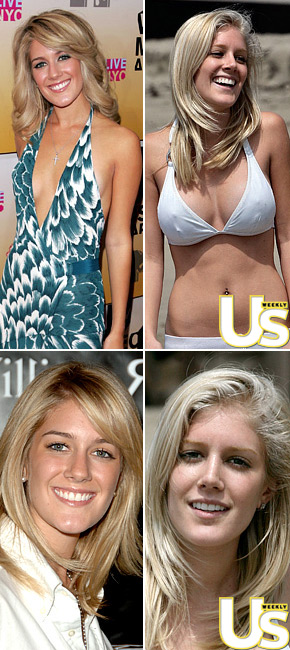 [Heidi+Montag+before+and+after.jpg]
