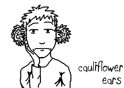 [cauliflowerears.jpg]