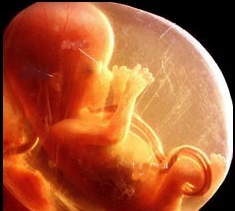 [Unborn%20baby.jpg]