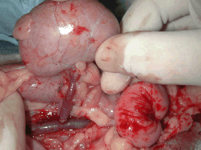 [Picture+or+Image+of+kidney_during_transplant_surgery.gif]
