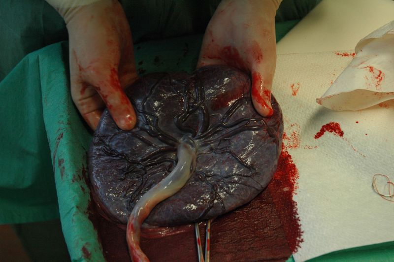 [placenta.jpg]