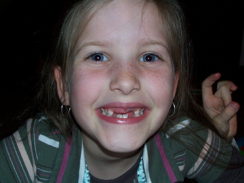 [Lauren+teeth+2.bmp]