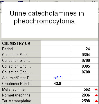[Urine+catecholamines+in+pheochromocytoma+1-2.png]
