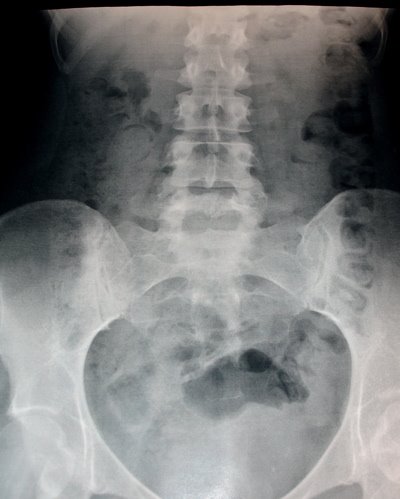 [x-ray.JPG]