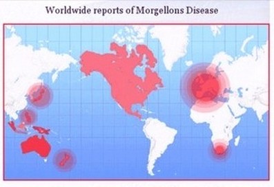[chemtrail-morgellons-map-small.jpg]