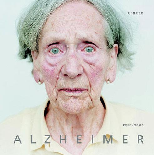 [cara-Alzheimer.jpg]