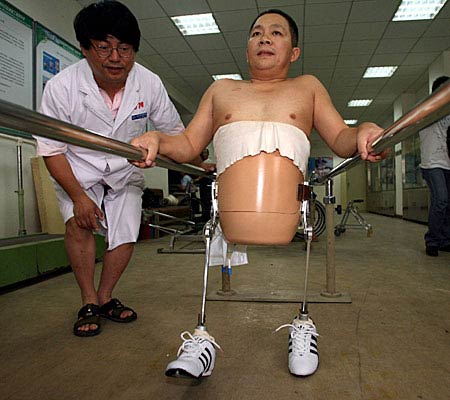 [Man+gets+robotic+legs+(in+China).jpg]