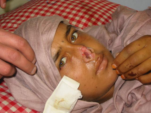 [afghani+women+abuse+2.jpg]
