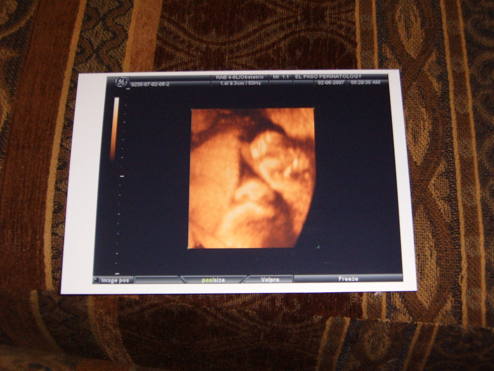 [2-6-07,+31+wks.+He+did+not+want+to+show+his+face,+but+you+can+see+his+nose+&+mouth.JPG]