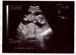 [jasper+golangco+baby+ultrasound.jpg]