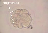[embrio3dfragm.jpg]
