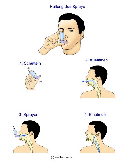 [Asthma-Patientenleitlinie-Asthmaspray-Neusortiert.jpg]