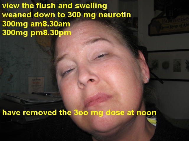 [2008_04_08_neurotin+dose+UPdate_MONDAY.jpg]