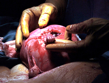 [fetus+hand.jpg]