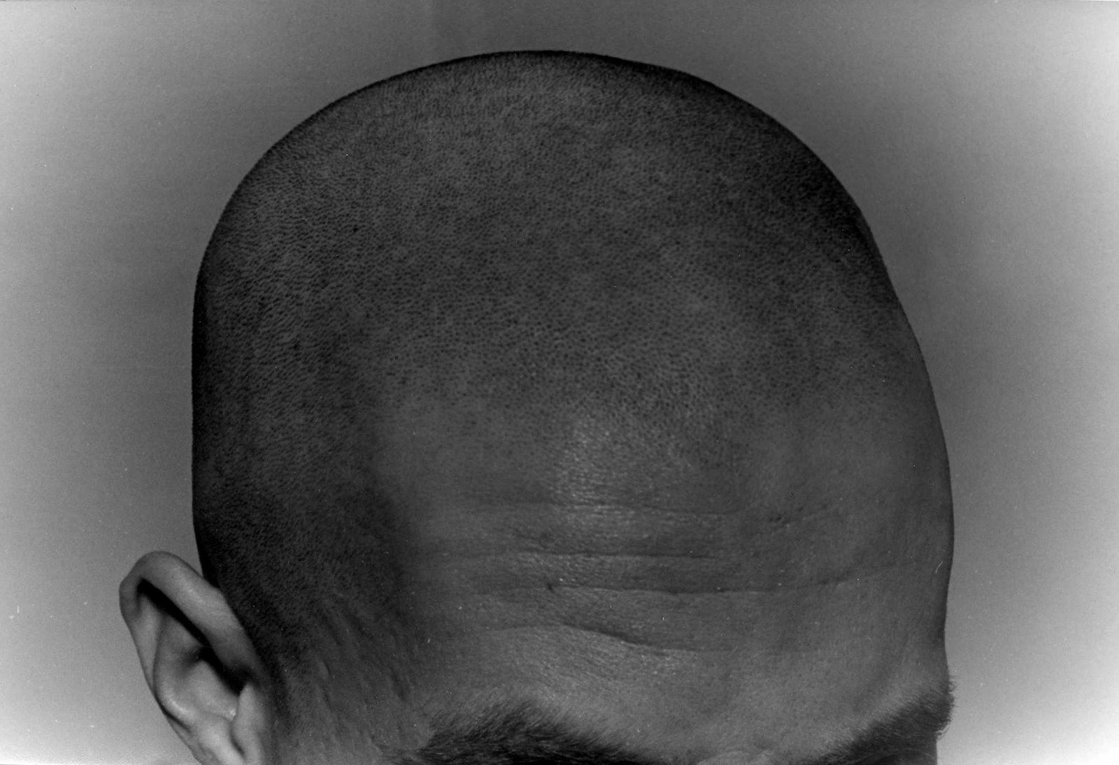 [bald,+1993.jpg]