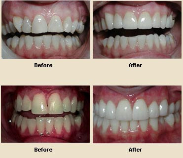 cosmetic+dentistry+teeth