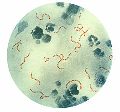 [240px-Streptococcus_pyogenes_01.jpg]