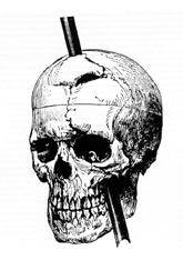 [Phineas_gage_-_1868_skull_diagram.jpg]