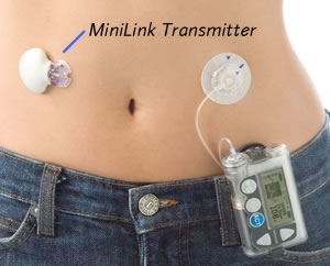 [minilink_transmitter_body.jpg]