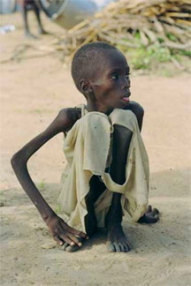 [Child-starving-sudan-3.jpg]