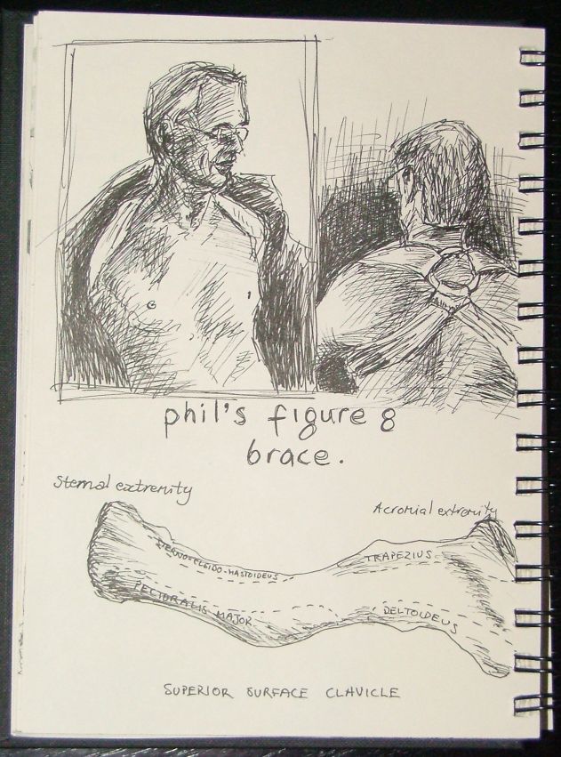 [Phil's+broken+collarbone.jpg]