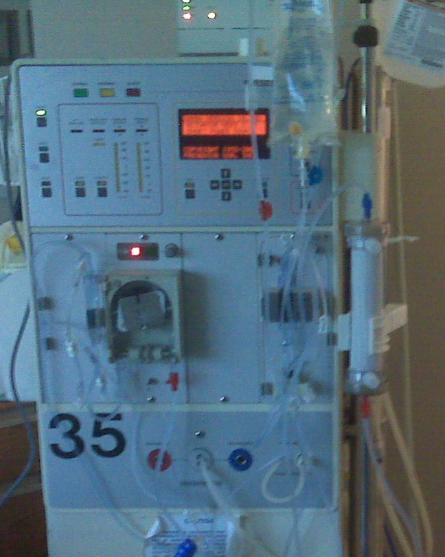 [dialysis+machine1.jpg]