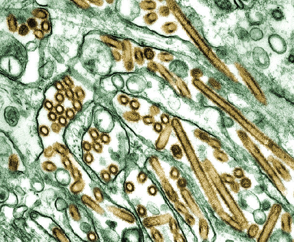 [Colorized_transmission_electron_micrograph_of_Avian_influenza_A_H5N1_viruses.jpg]