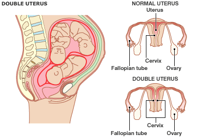 [double+uterus.gif]