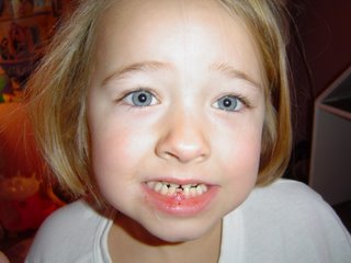 [julia's+tooth.jpg]