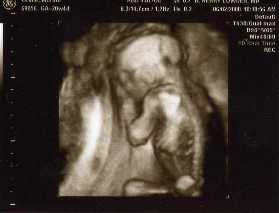 [Ultrasound+-+Baby#3+20Wk022.jpg]