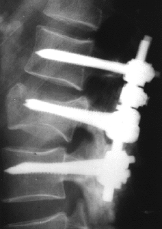 [neck+with+screws.gif]